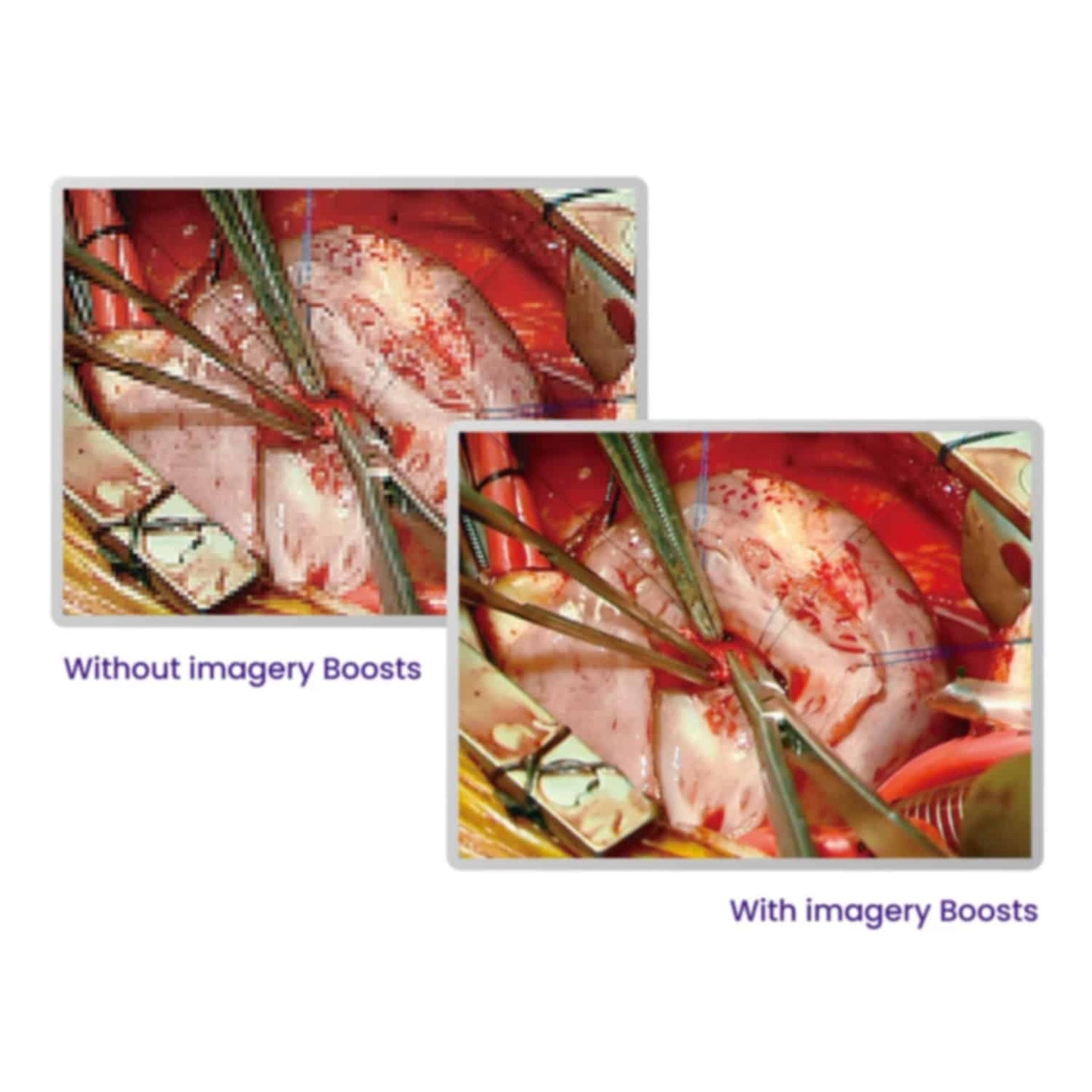 BenQ - BenQ 27" 4K Ultra-HD Chirurgie-Monitor