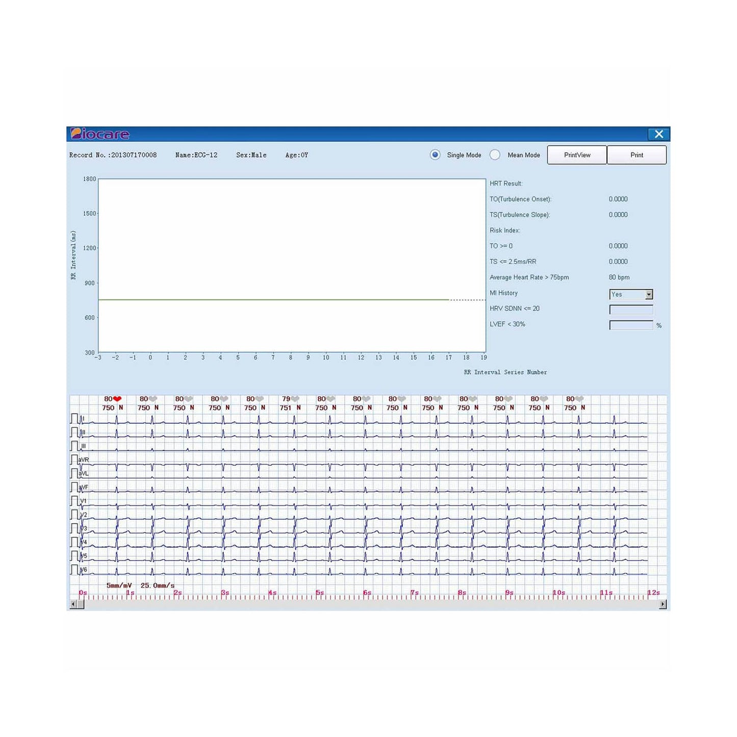 PC-EKG Biocare ECG-2000