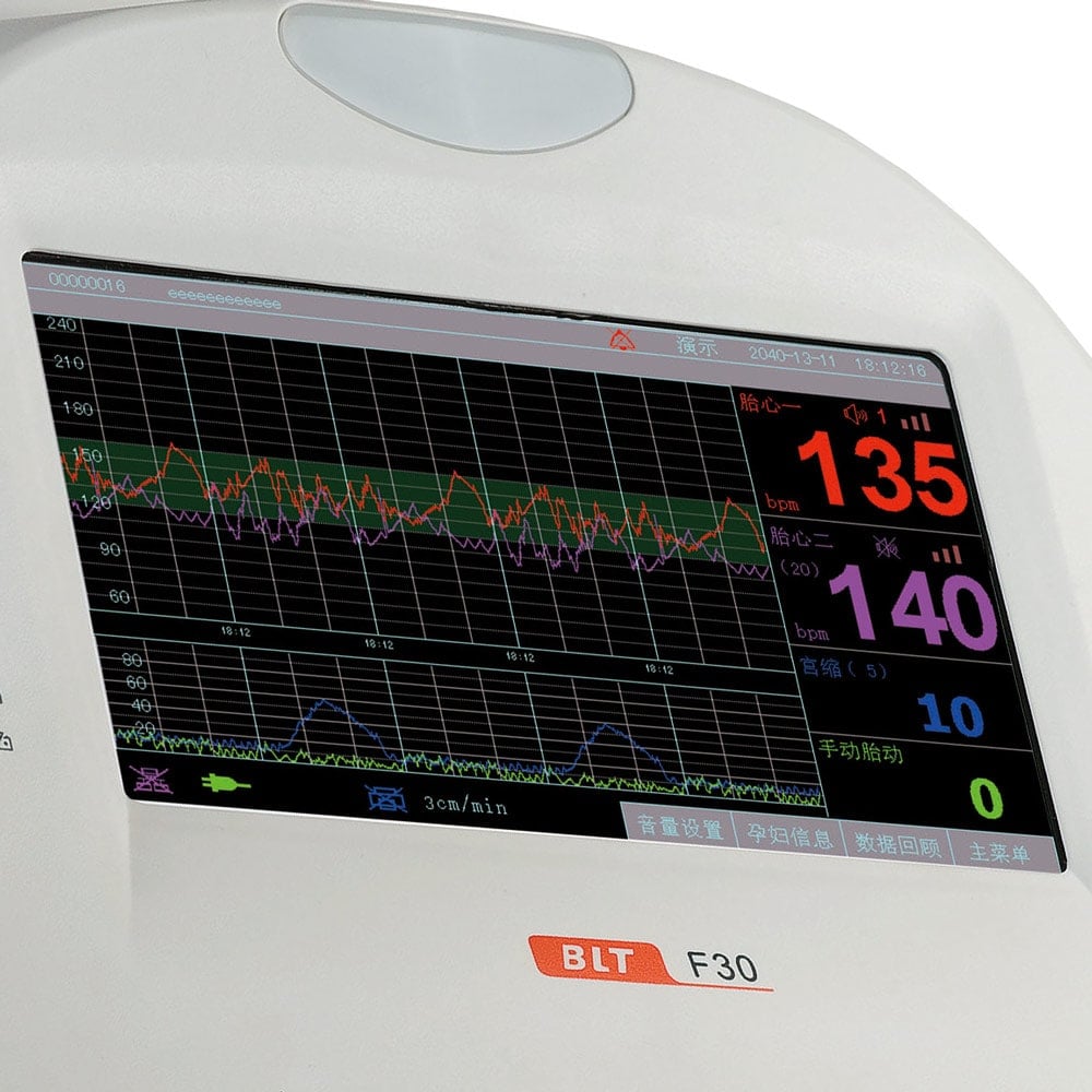 Fetalmonitor F30