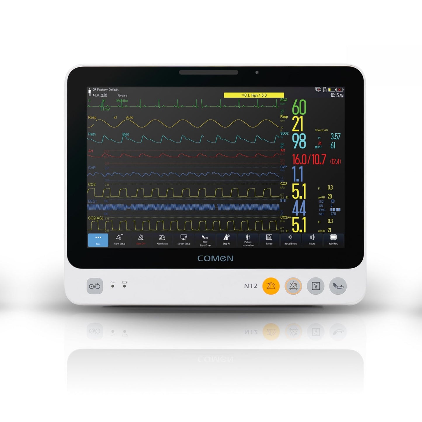 Comen N12 Patientenmonitor