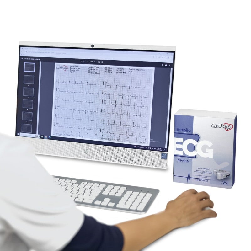 CardioNS E2