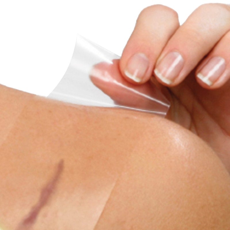 Cerederm® Silikonpflaster