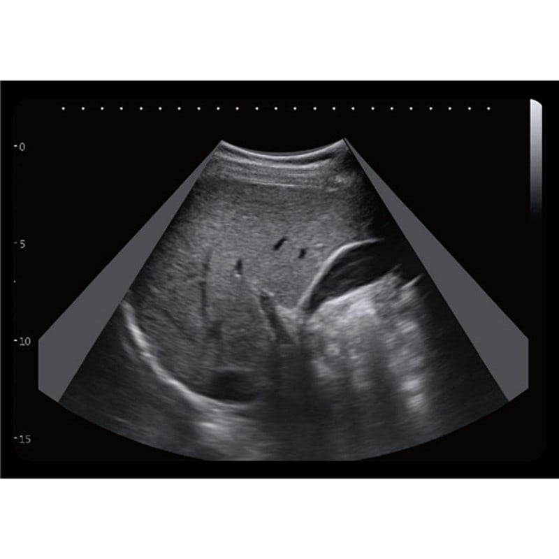 CBit6 Ultraschallgerät
