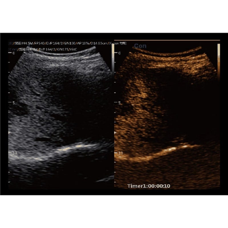 CBit9 Farbdoppler-Ultraschallsystem