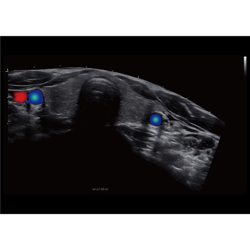 CBit9 Farbdoppler-Ultraschallsystem