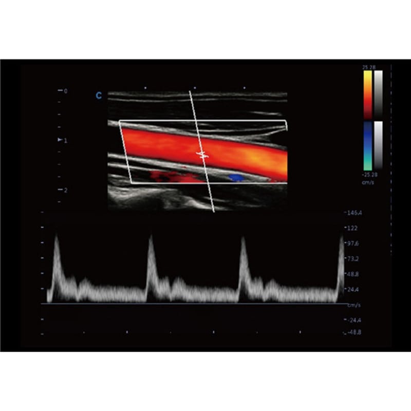 CBit9 Farbdoppler-Ultraschallsystem