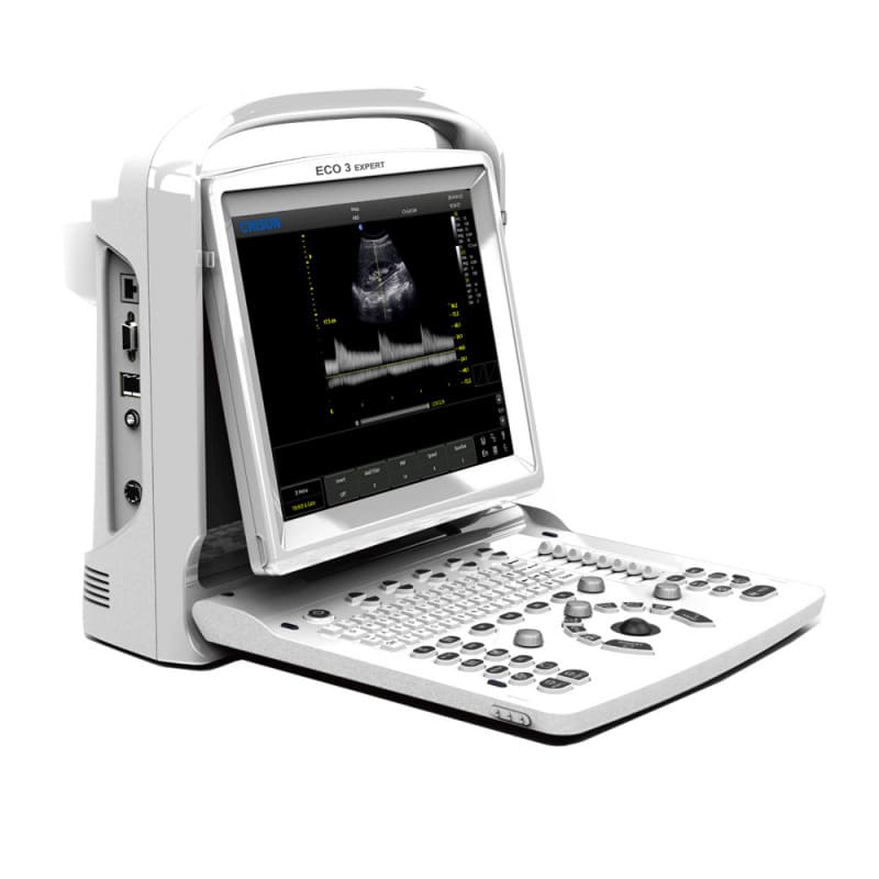 CHISON ECO3 Expert Ultraschallgerät