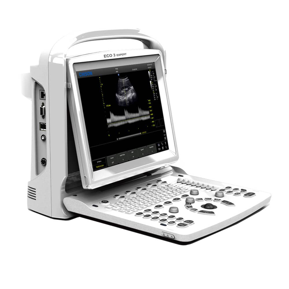 CHISON ECO3 Expert Ultraschallgerät