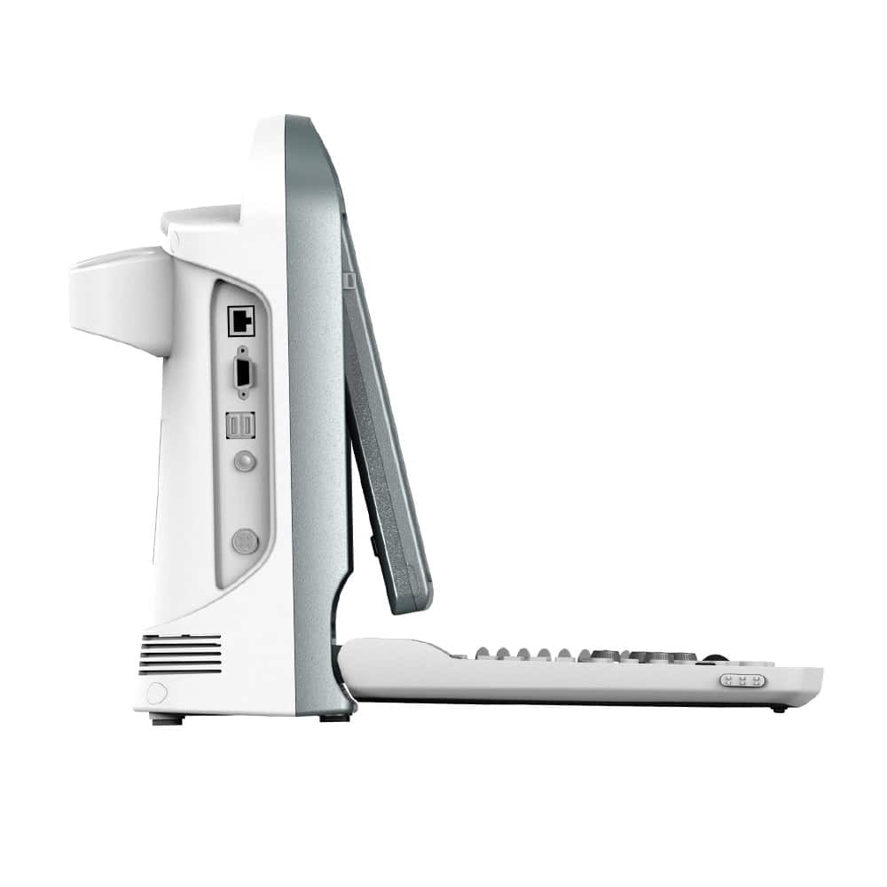 CHISON ECO5 Ultraschallgerät mit Farbdoppler