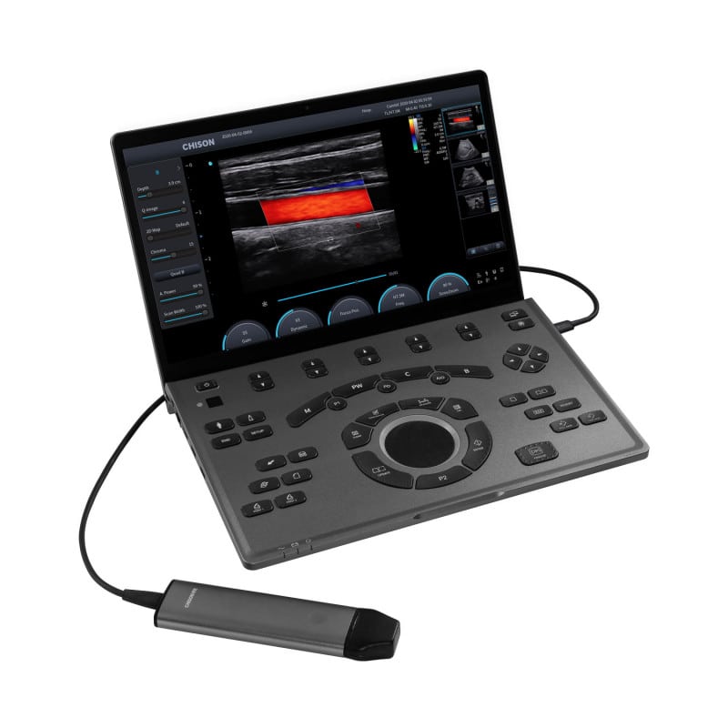 CHISON SonoAir 30