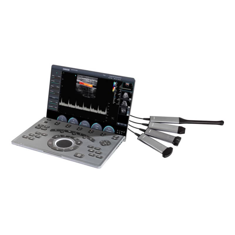 CHISON SonoAir 30