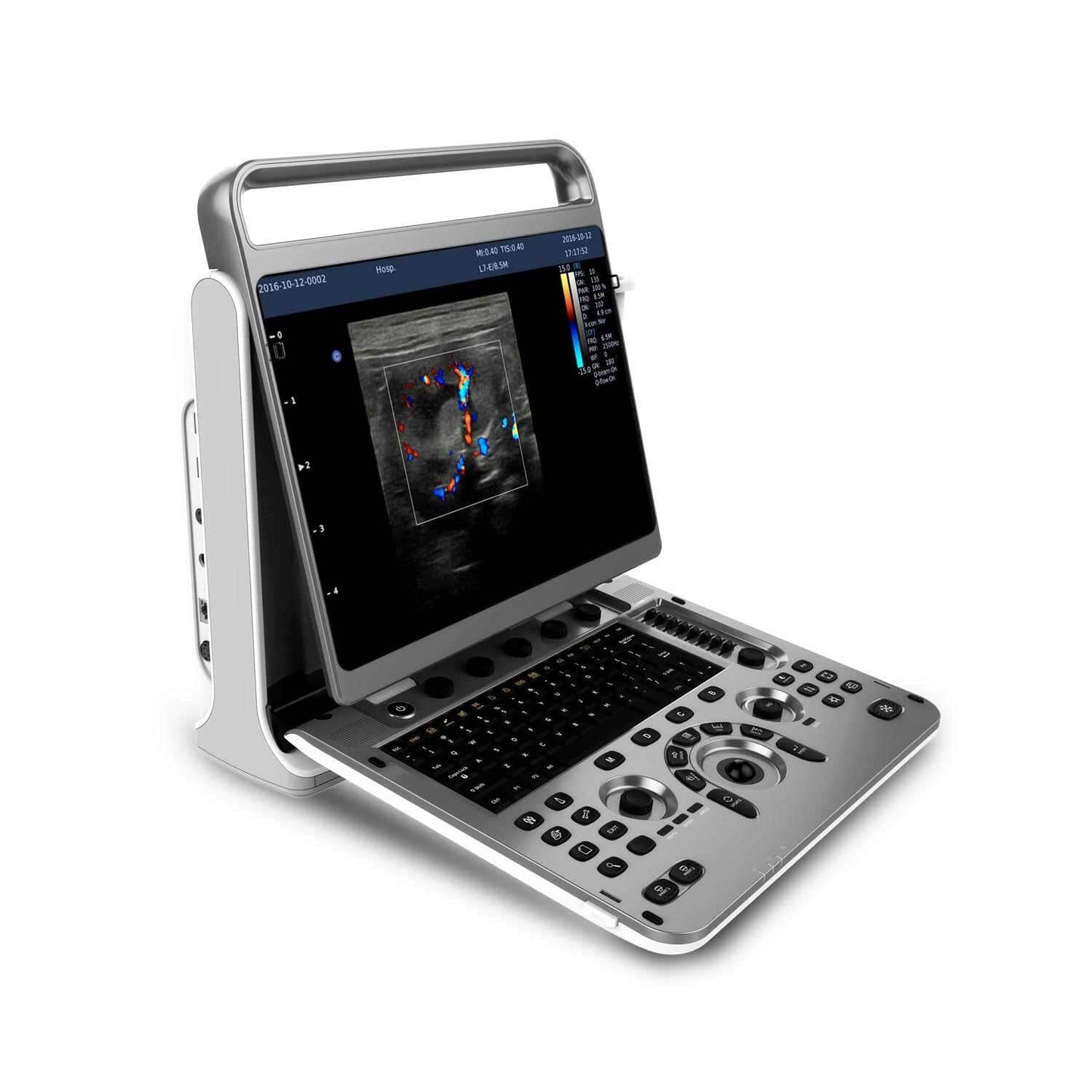 Chison EBit 30