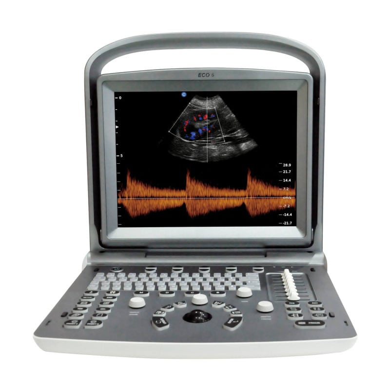 Chison ECO 6 Ultraschallgerät