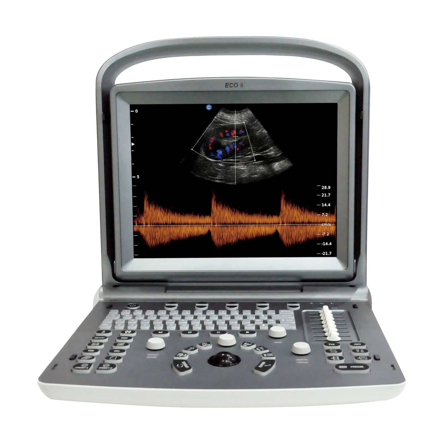 Chison ECO 6 Ultraschallgerät