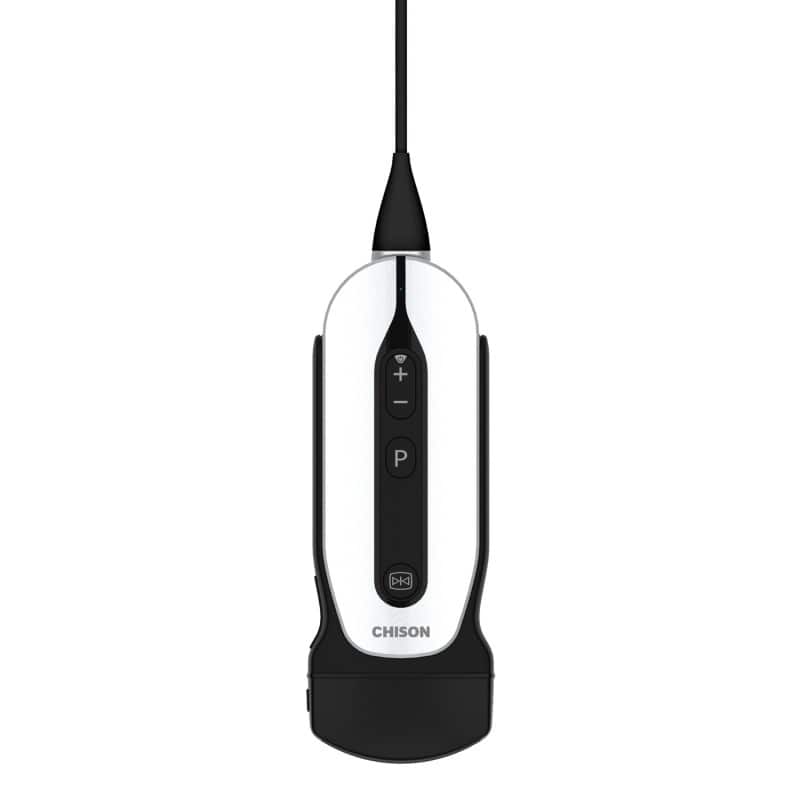 Chison portables Ultraschallgerät «SonoEye»