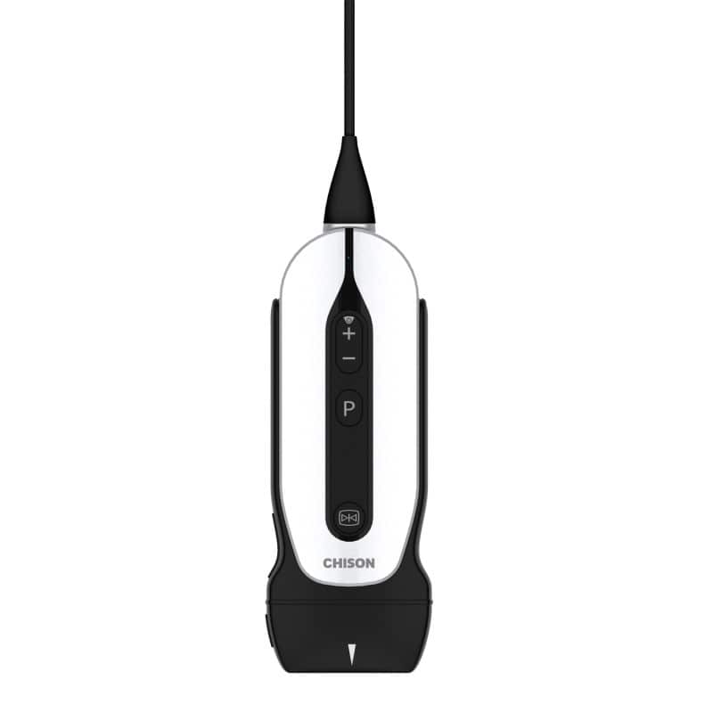 Chison portables Ultraschallgerät «SonoEye»
