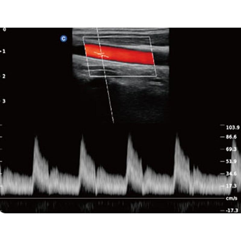 QBit5 Ultraschallgerät