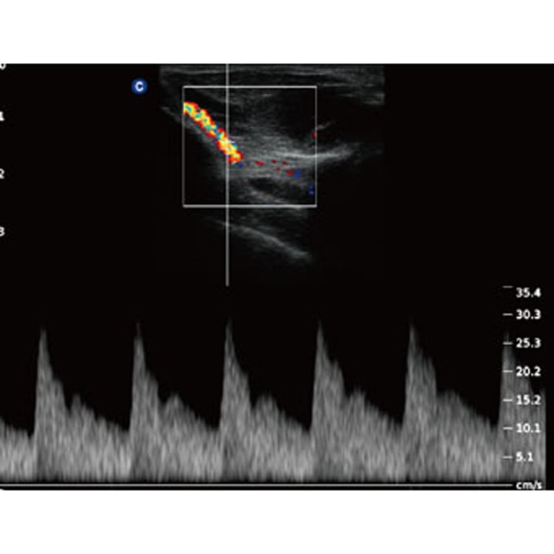 QBit5 Ultraschallgerät