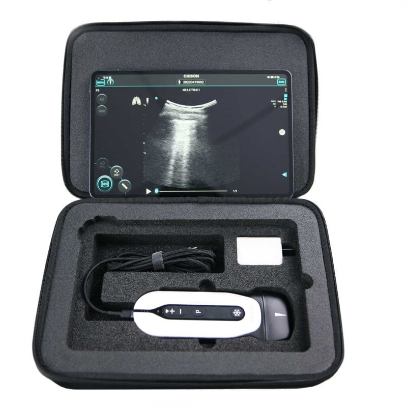 Transportkoffer für Chison «SonoEye»