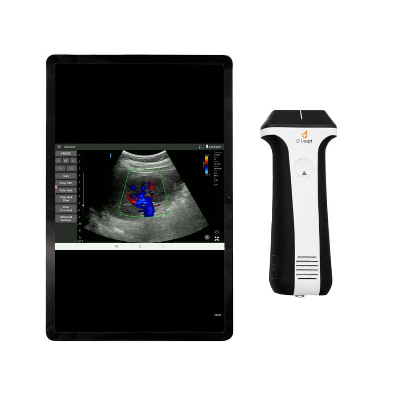 D-Heart handheld Ultraschallgerät