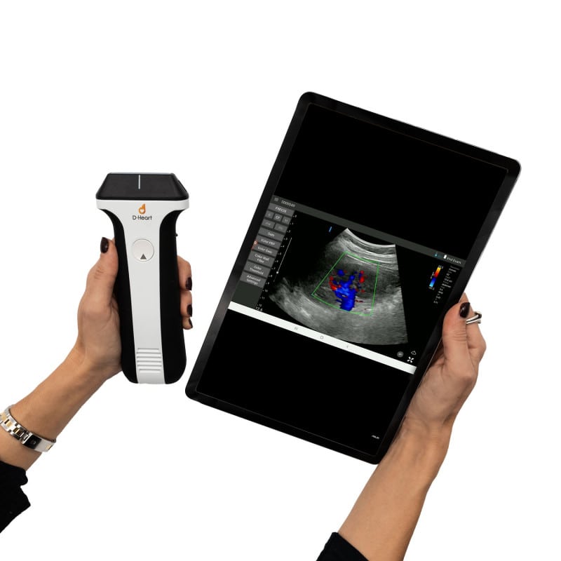 D-Heart handheld Ultraschallgerät