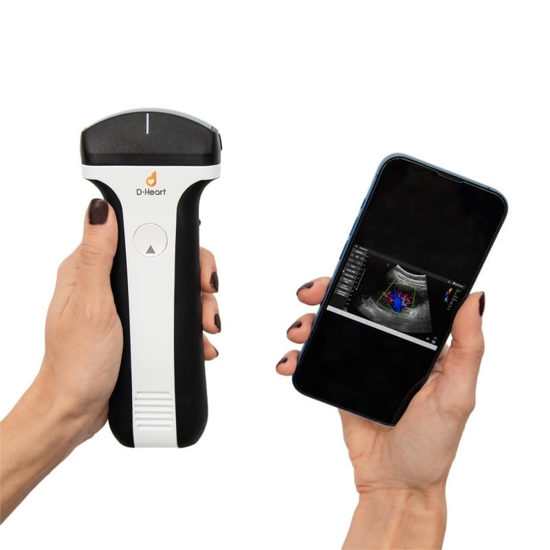 D-Heart handheld Ultraschallgerät