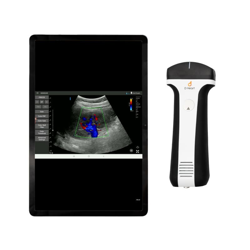 D-Heart handheld Ultraschallgerät