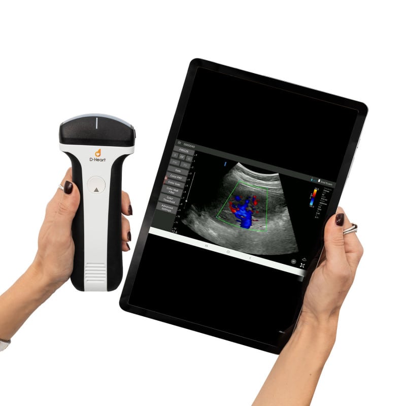D-Heart handheld Ultraschallgerät
