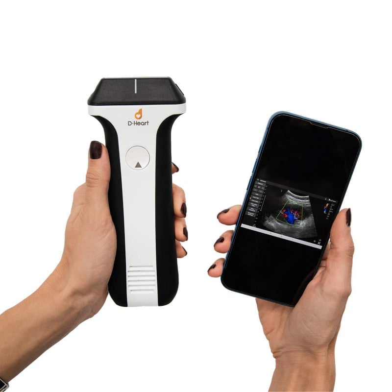 D-Heart handheld Ultraschallgerät