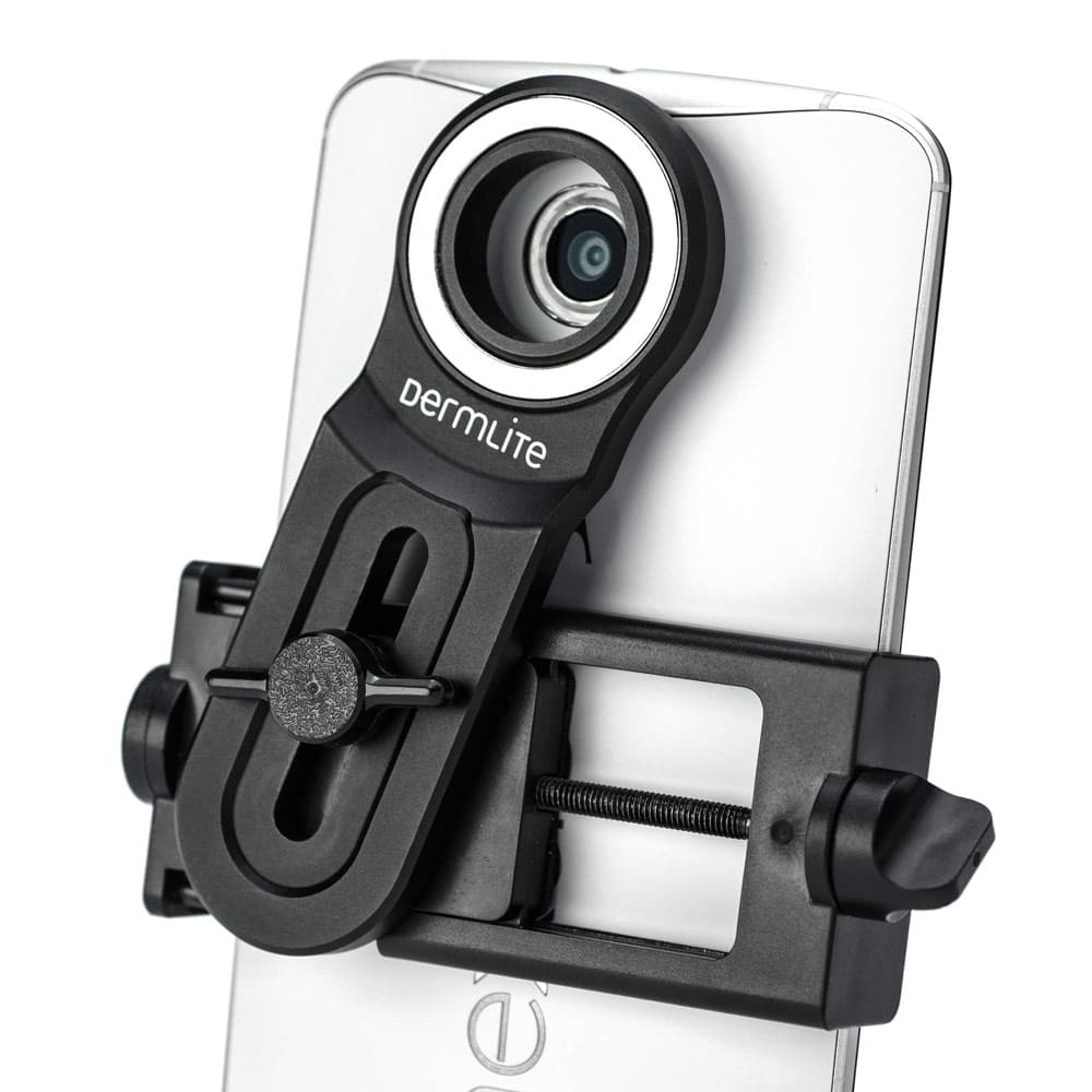 DermLite Smartphone-Universaladapter