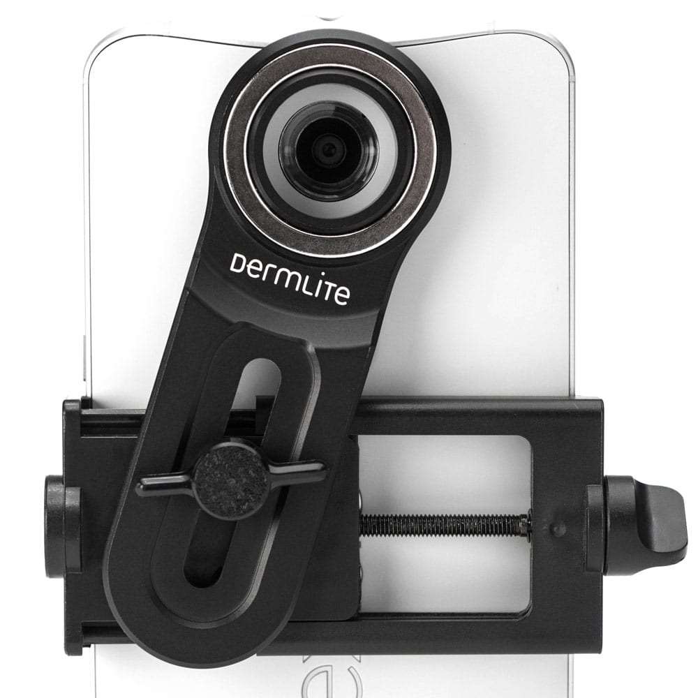 DermLite Smartphone-Universaladapter