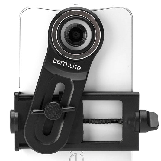 DermLite - DermLite Smartphone-Universaladapter