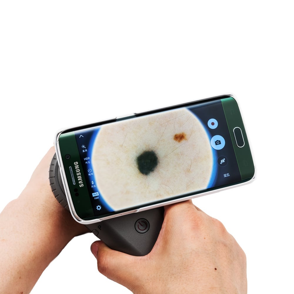 DermoScan Smartphone-Adapter
