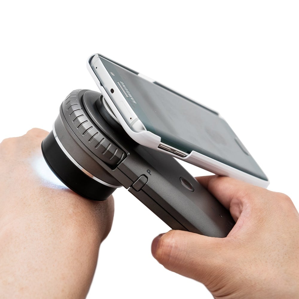 DermoScan Smartphone-Adapter