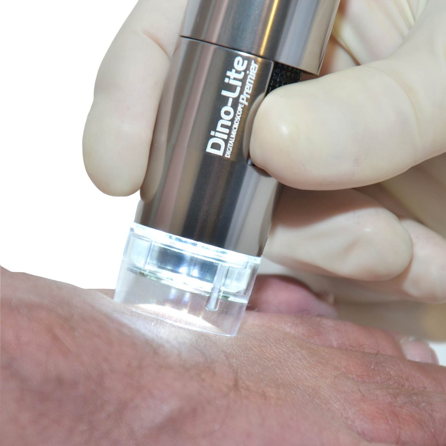 Dino-Lite PodoScope
