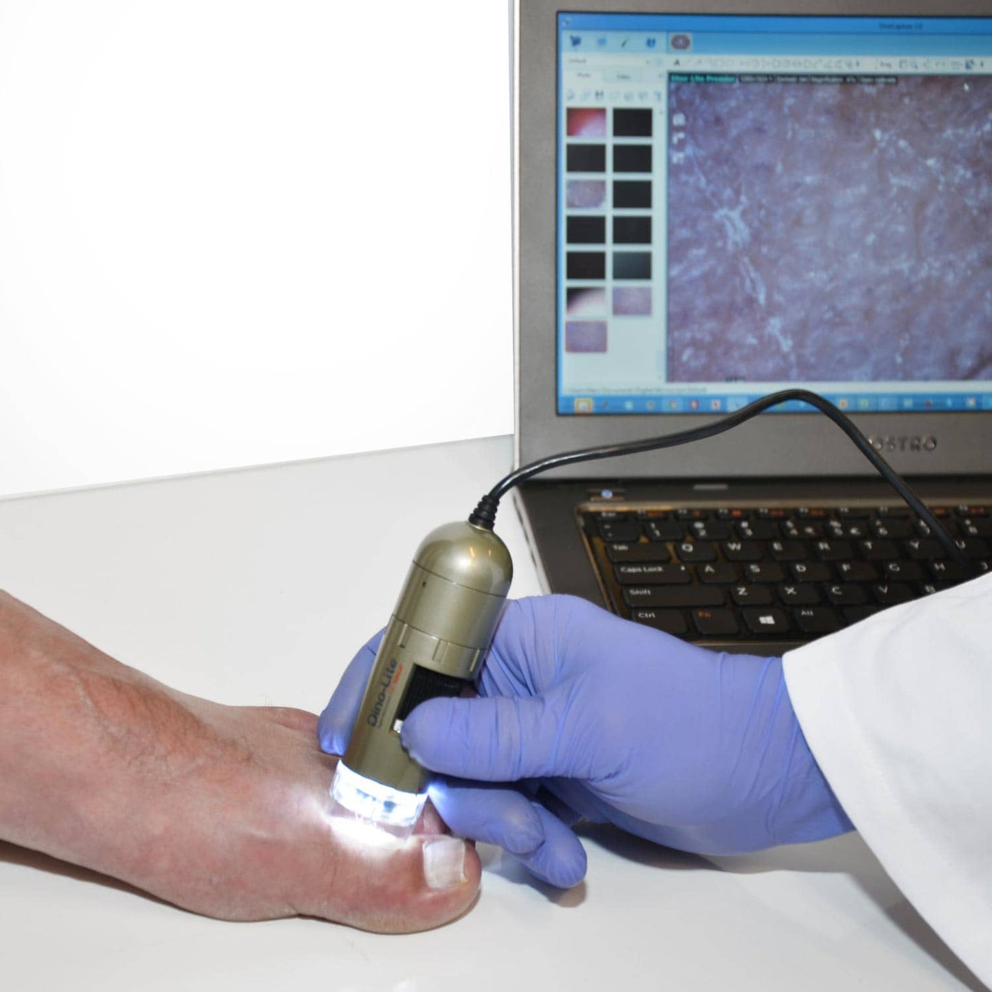 Dino-Lite PodoScope