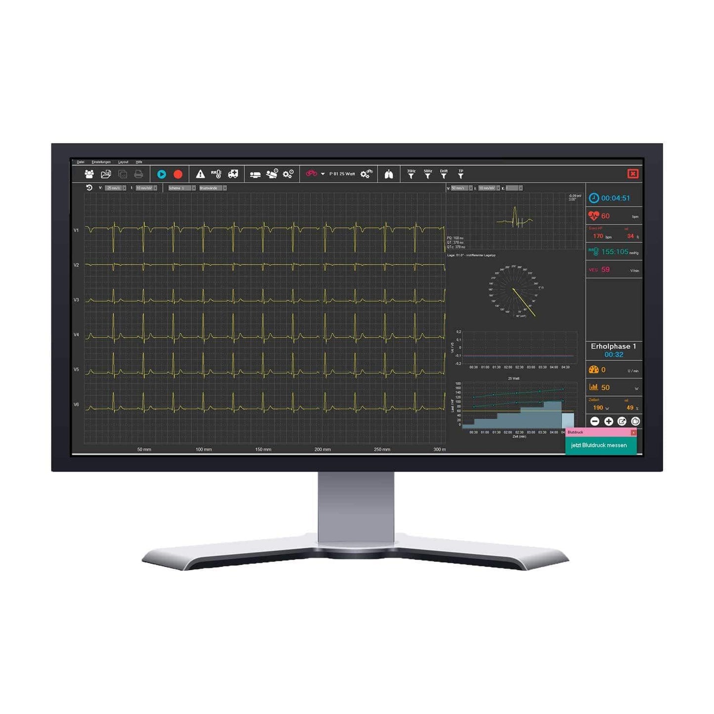 SmartScript Ergometrie