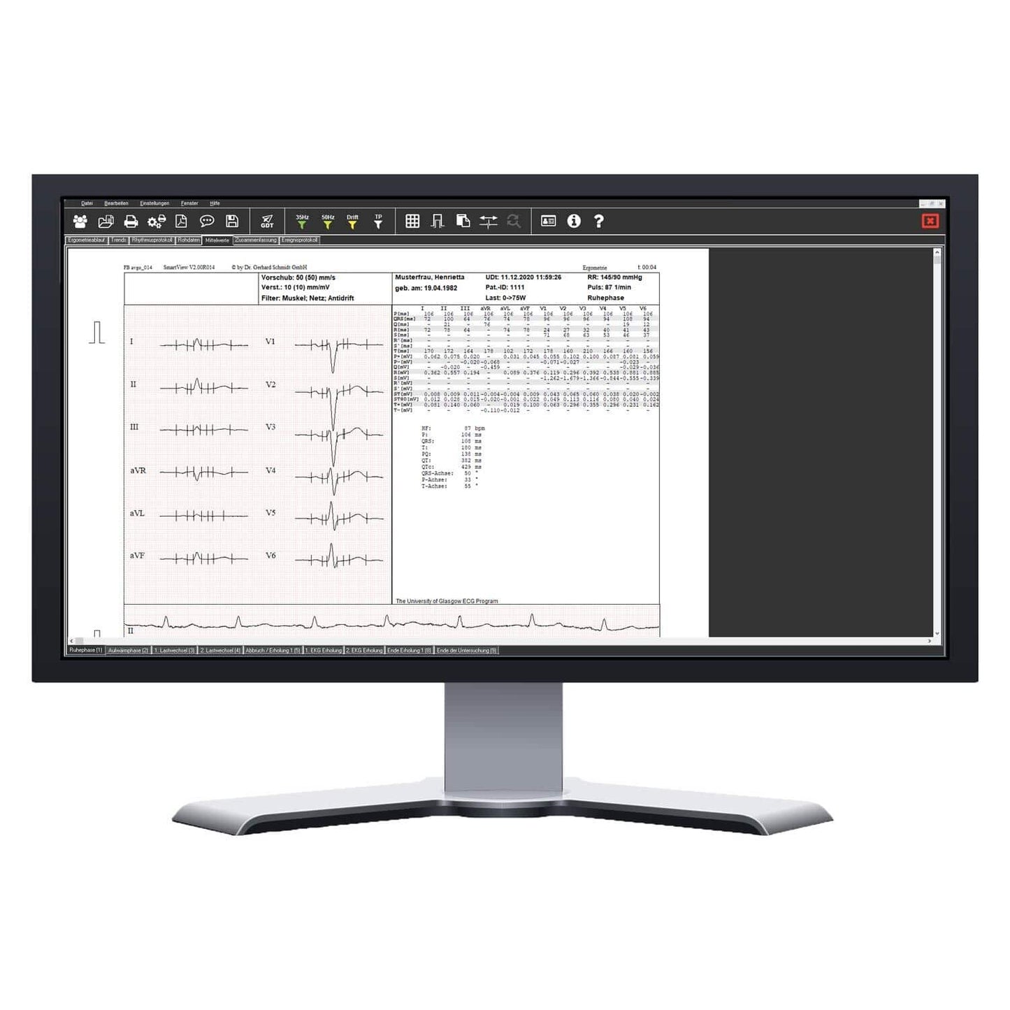 SmartScript Ergometrie