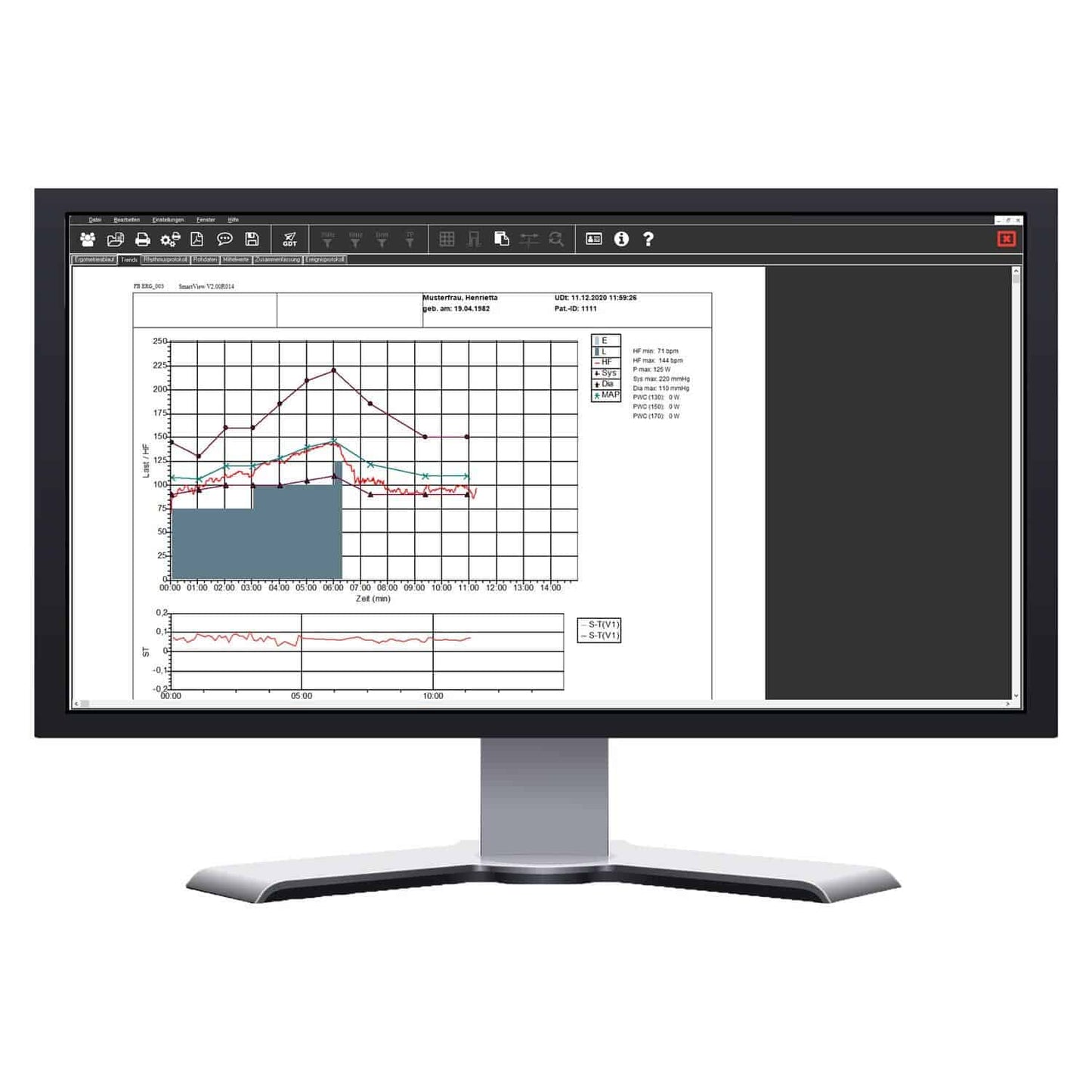 SmartScript Ergometrie