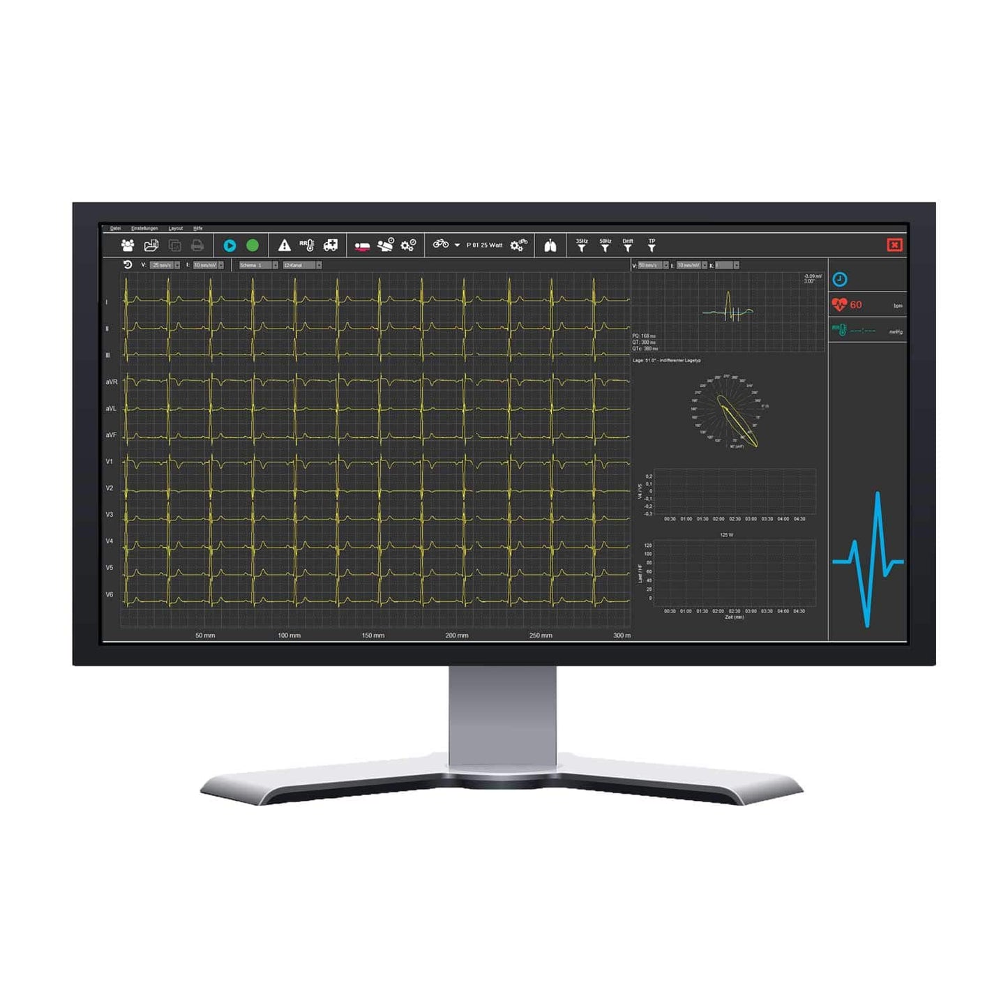 SmartScript PC-EKG-System