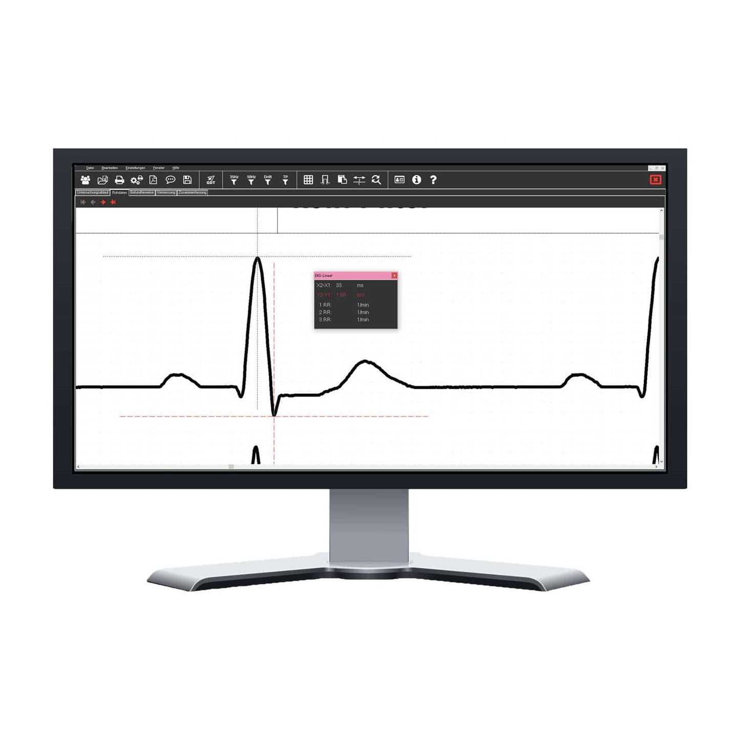 SmartScript PC-EKG-System