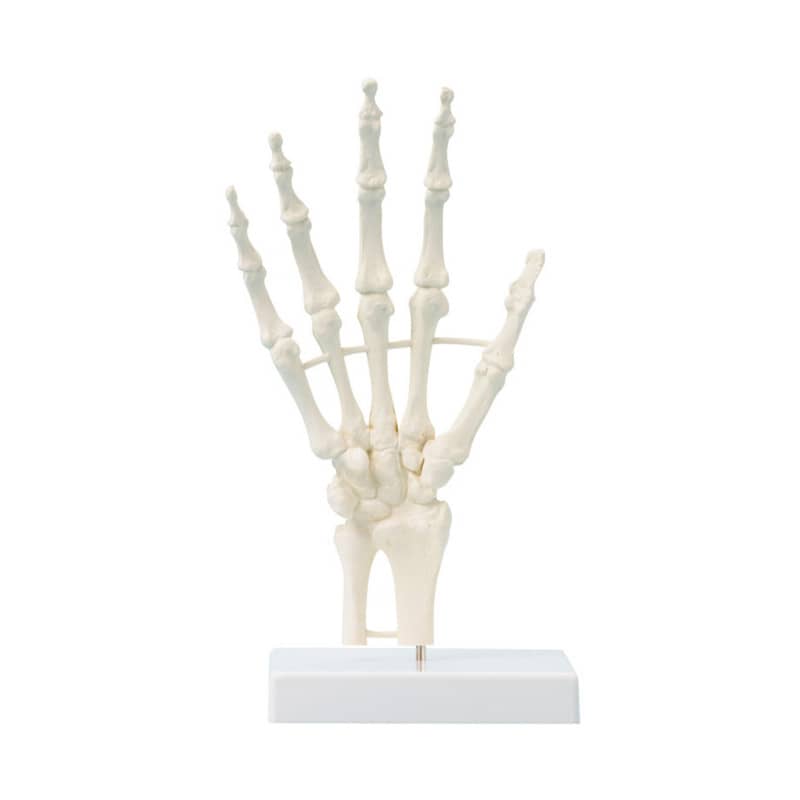 Handskelett mit Strukturen, unbeweglich