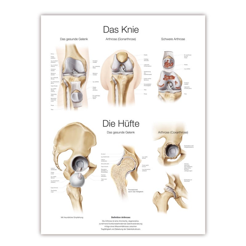 Lehrtafel Das Knie/ Die Hüfte