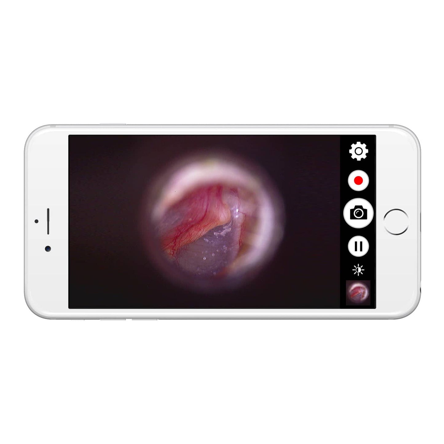 Firefly DE570 W-LAN HD Digital-Otoskop