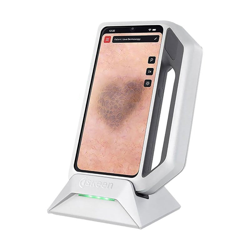 FotoFinder® Dermatoscopy Premium