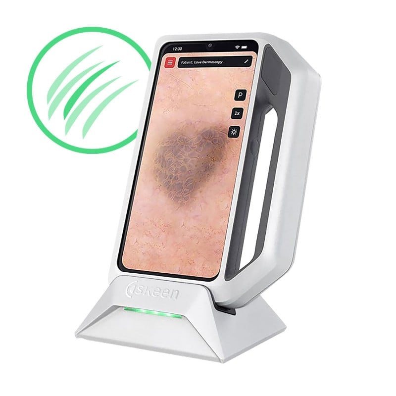 FotoFinder® Trichoscopy