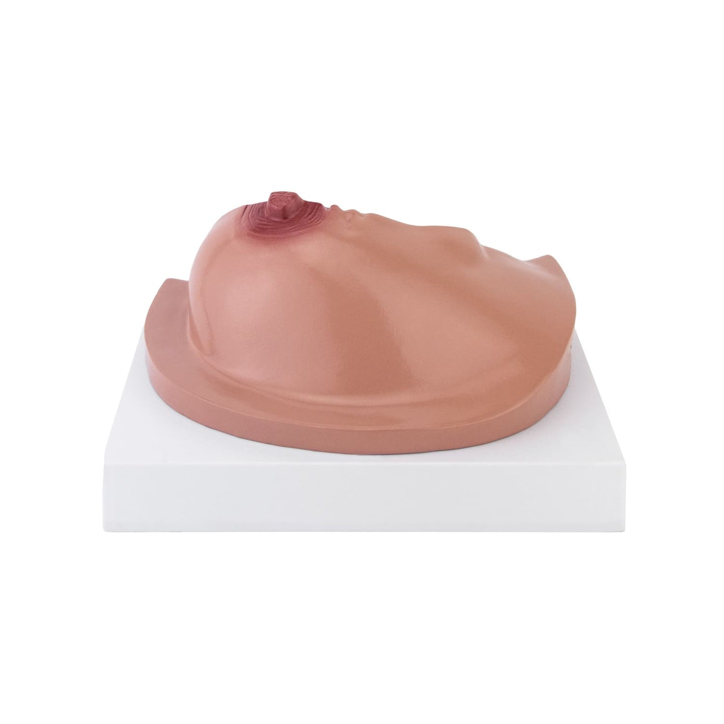 HeineScientific - Modell der weiblichen Brust mit Erkrankungen