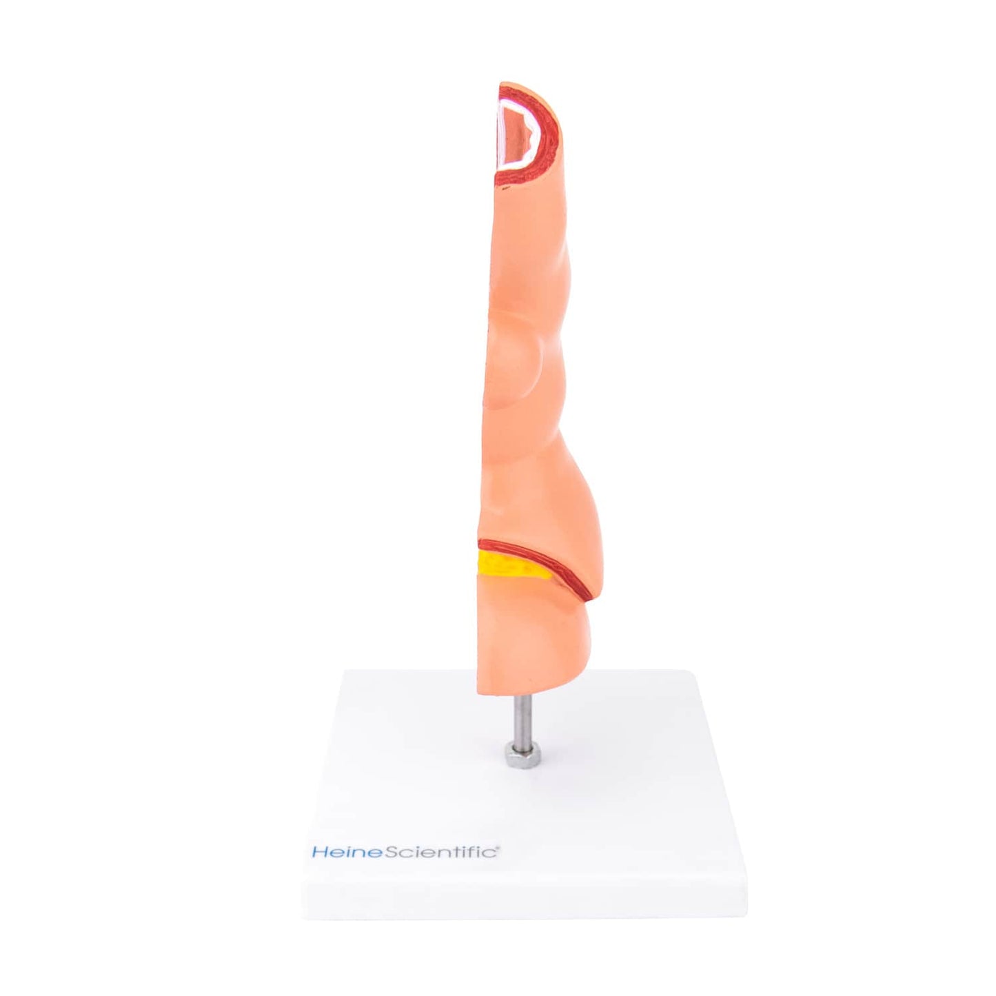 HeineScientific - Ösophagus-Modell mit Erkrankungen