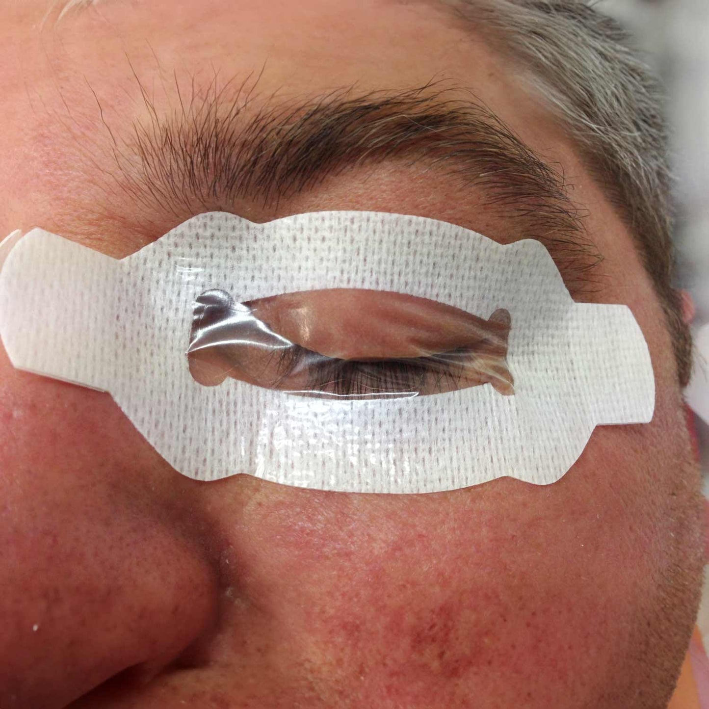 EyePro Augenschutzpflaster
