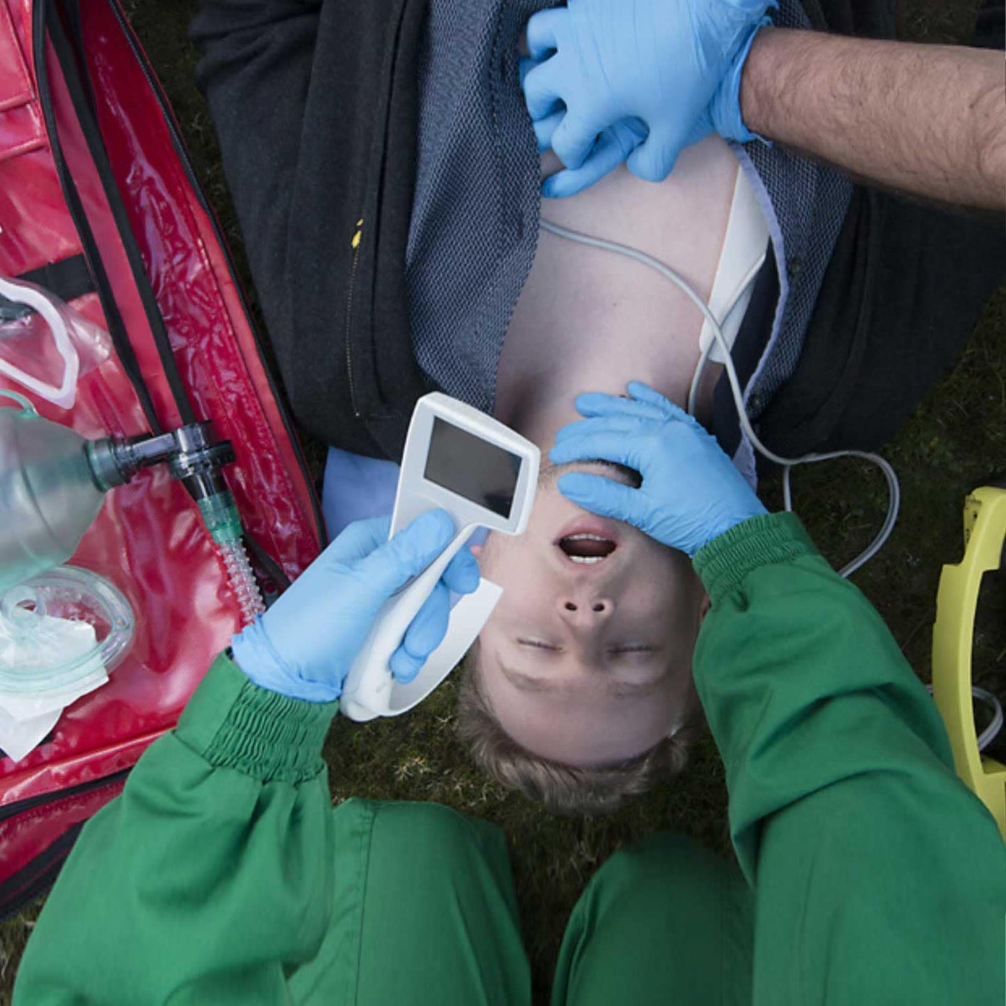 Intersurgical GmbH - i-view Videolaryngoskop von Intersurgical